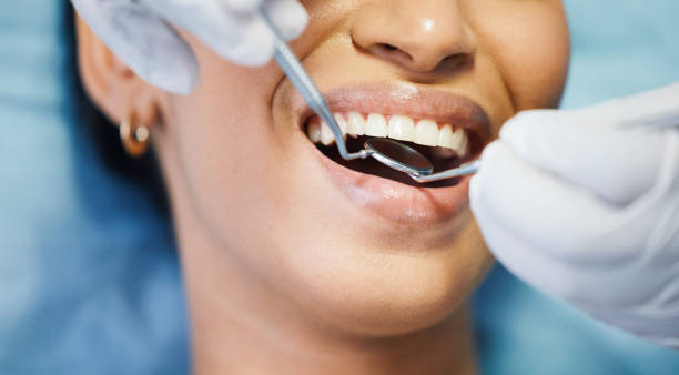 Best Pediatric Emergency Dentist in Granby, MO